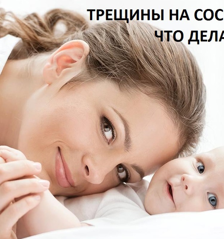 Заметки консультанта: трещины на сосках - что делать?