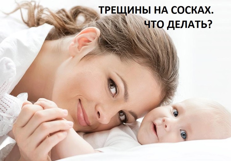 Заметки консультанта: трещины на сосках - что делать?
