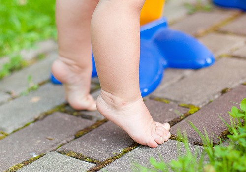 Что делать, если ребенок ходит на носочках?